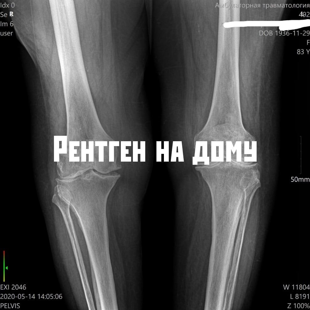 Рентген воронеж. Рентген 17.0. Рентген на дому шейки бедра. Выездной рентген на дому. Сделать рентген на дому.